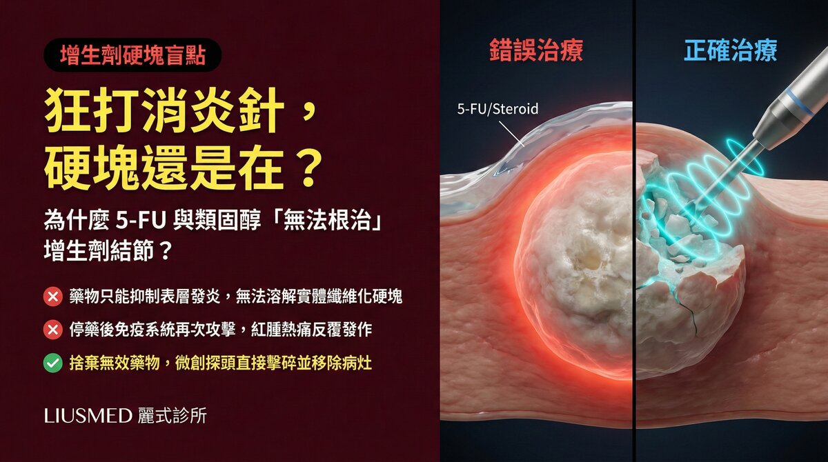 為什麼一直打類固醇或5-FU消炎針無法根治膠原蛋白增生劑硬塊?