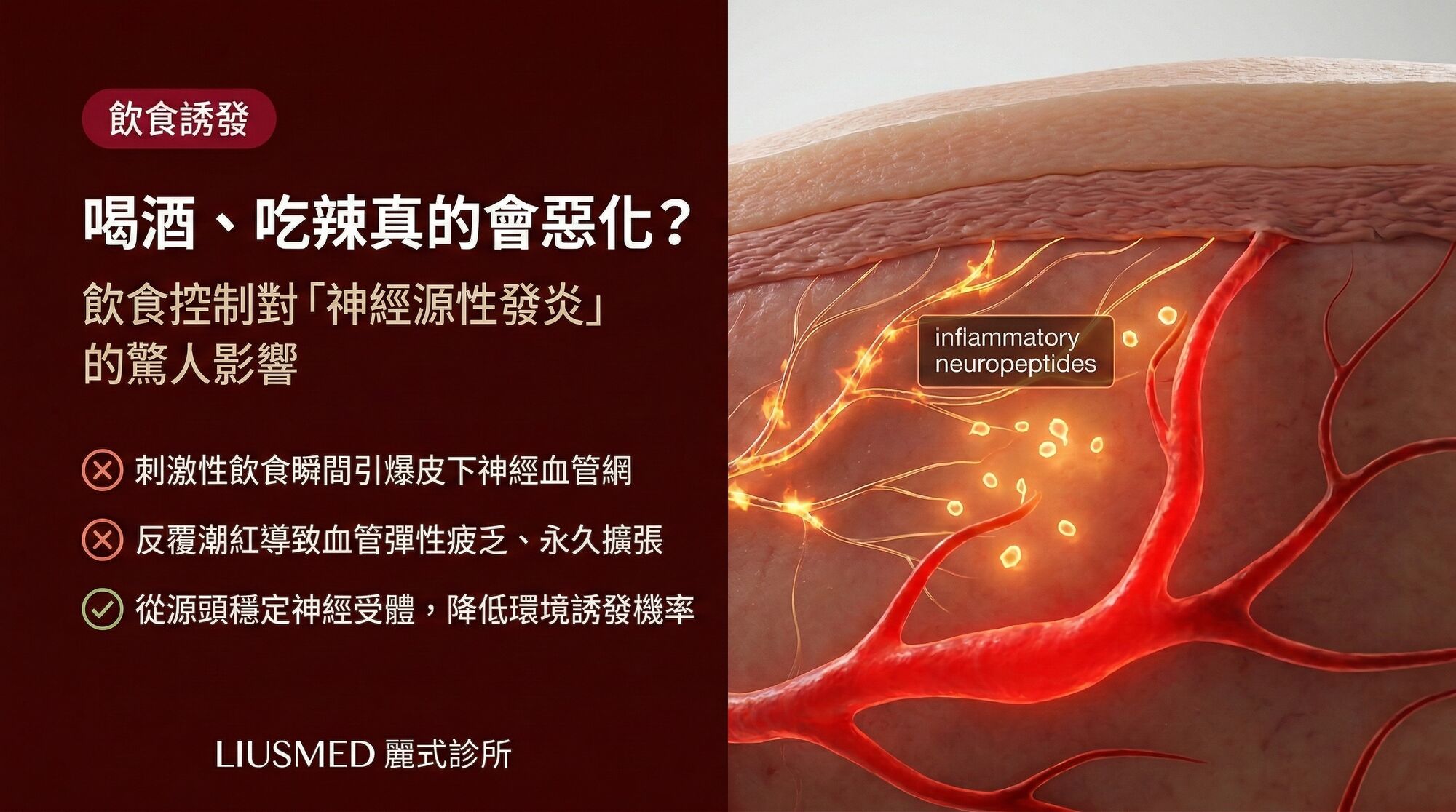 喝酒、吃辣真的會讓酒糟惡化嗎?飲食控制對「神經源性發炎」的影響