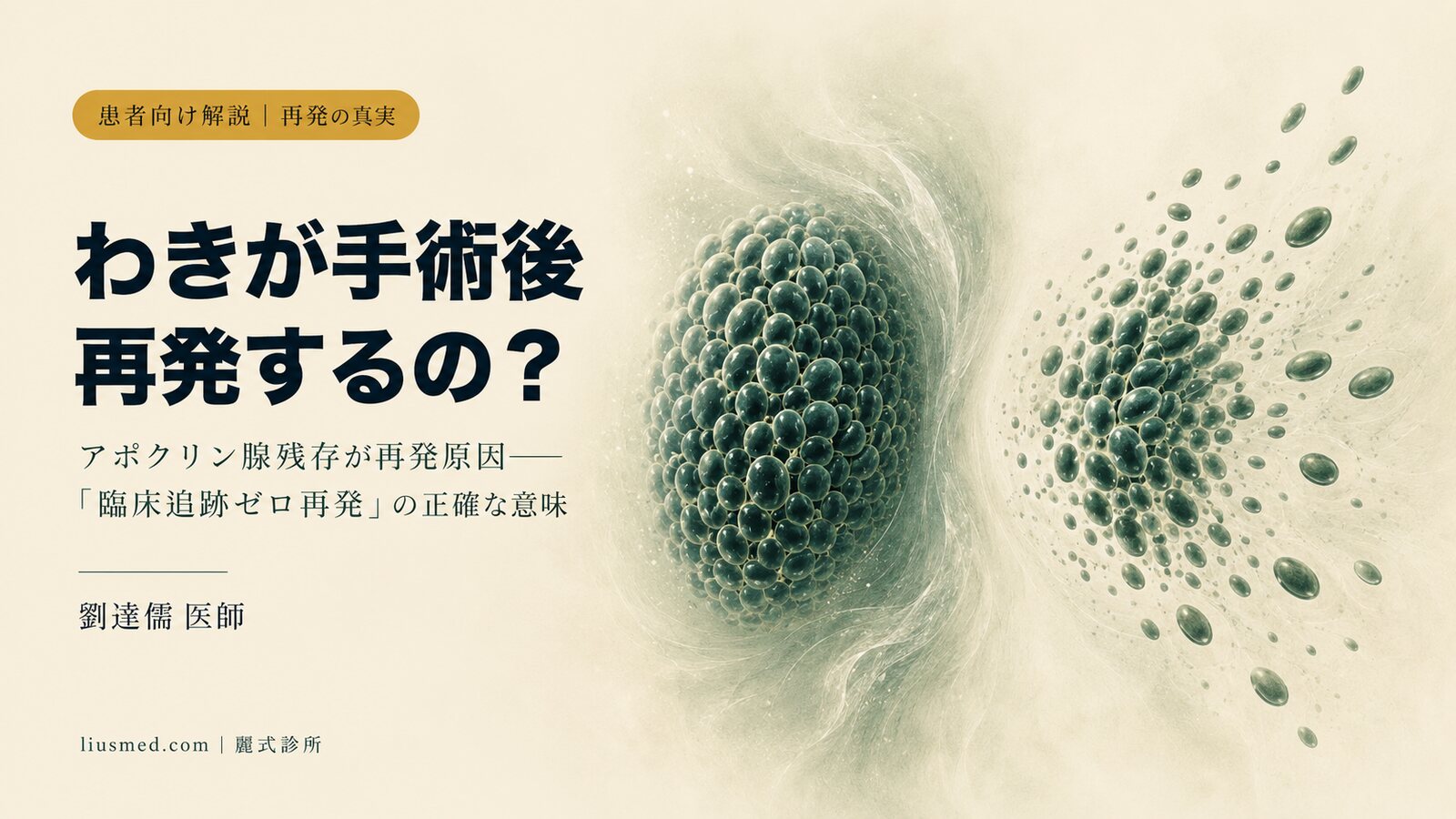 わきが手術後に再発する?アポクリン腺残存と「臨床追跡ゼロ再発」の真実