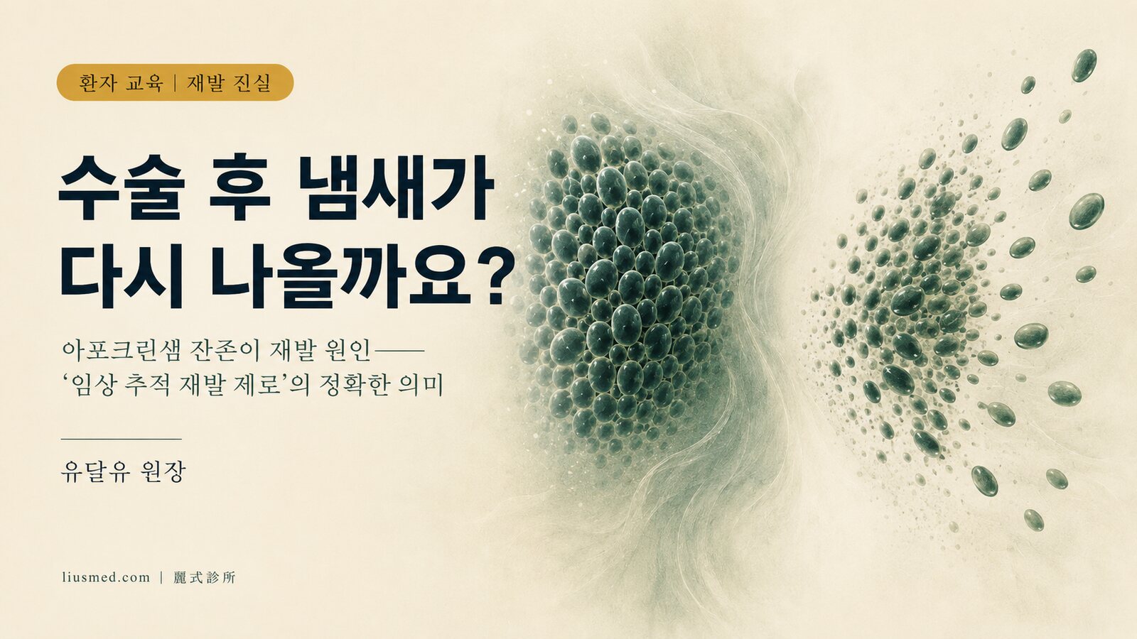 액취증 수술 후 재발하나요? 아포크린샘 잔존과 '임상 추적 재발 제로'의 진실