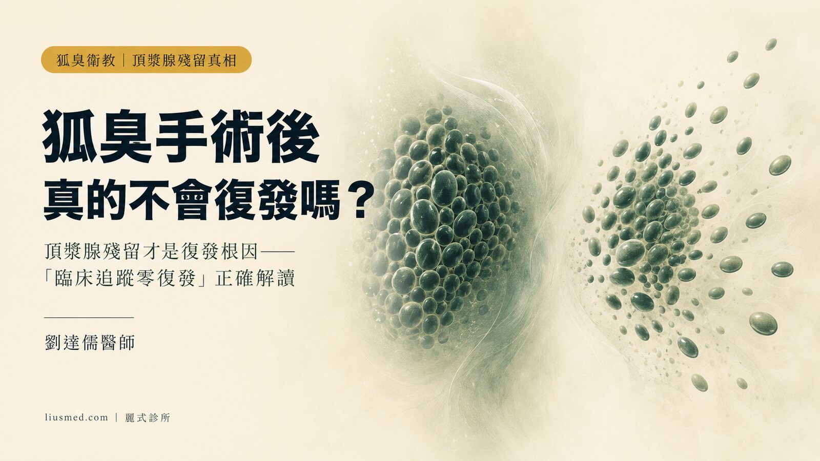 狐臭手術後會不會復發?頂漿腺殘留與「臨床追蹤零復發」的真相