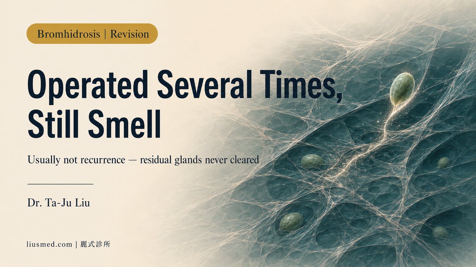 Operated Several Times and Still Smell: Re-Clearing Residual Apocrine Glands, and How to Judge Repeat Revision Surgery
