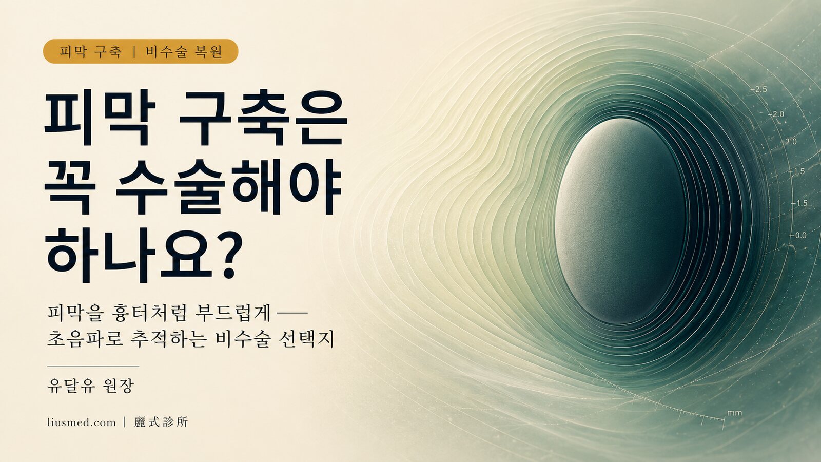 피막 구축은 반드시 수술로 제거해야 하나요? 비수술 '연화 복원'과 초음파 추적이라는 임상적 관찰
