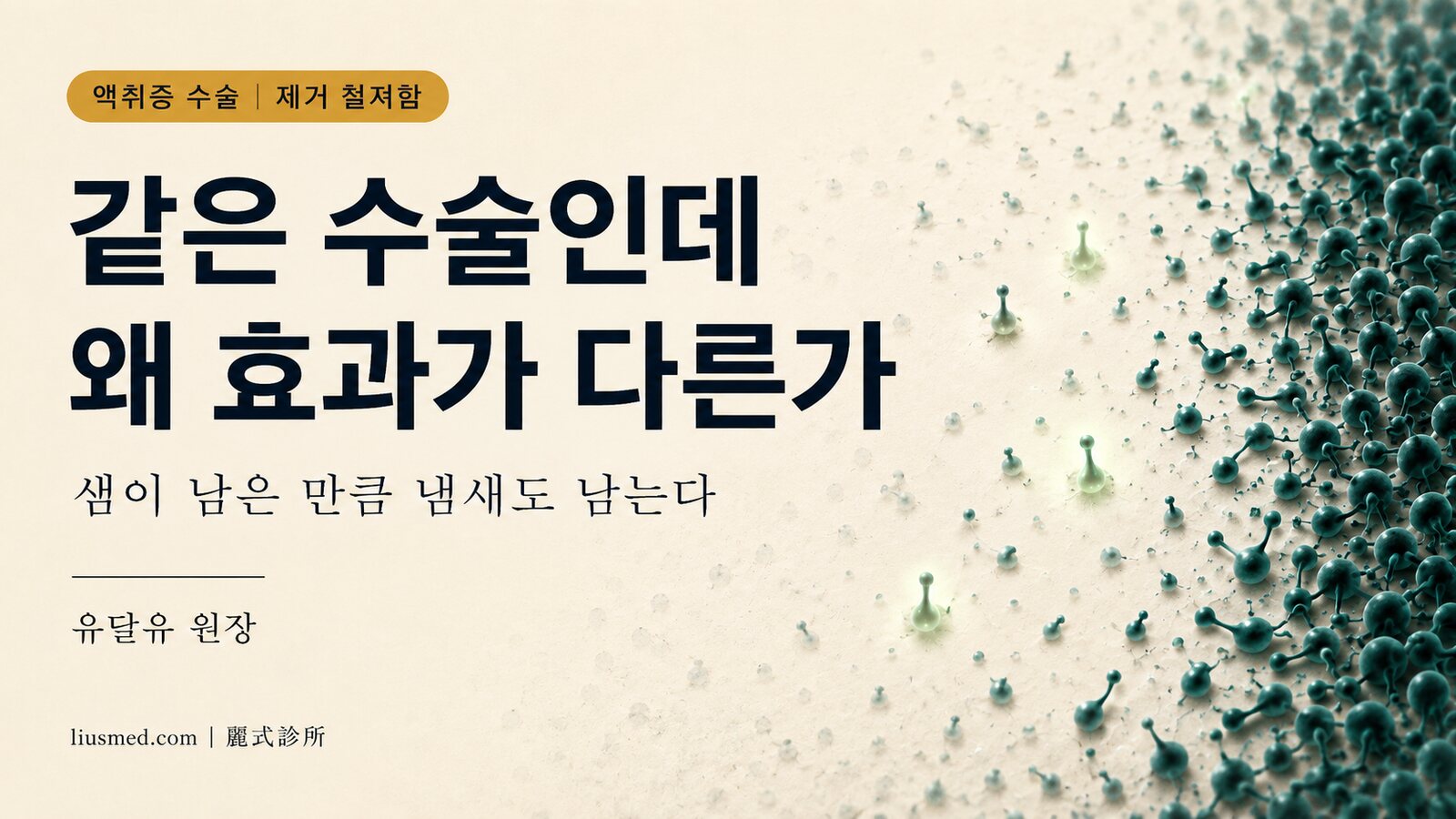 같은 액취증 수술인데 왜 효과가 이렇게 다른가 — 관건은 아포크린샘을 '얼마나 철저히 제거했는가'