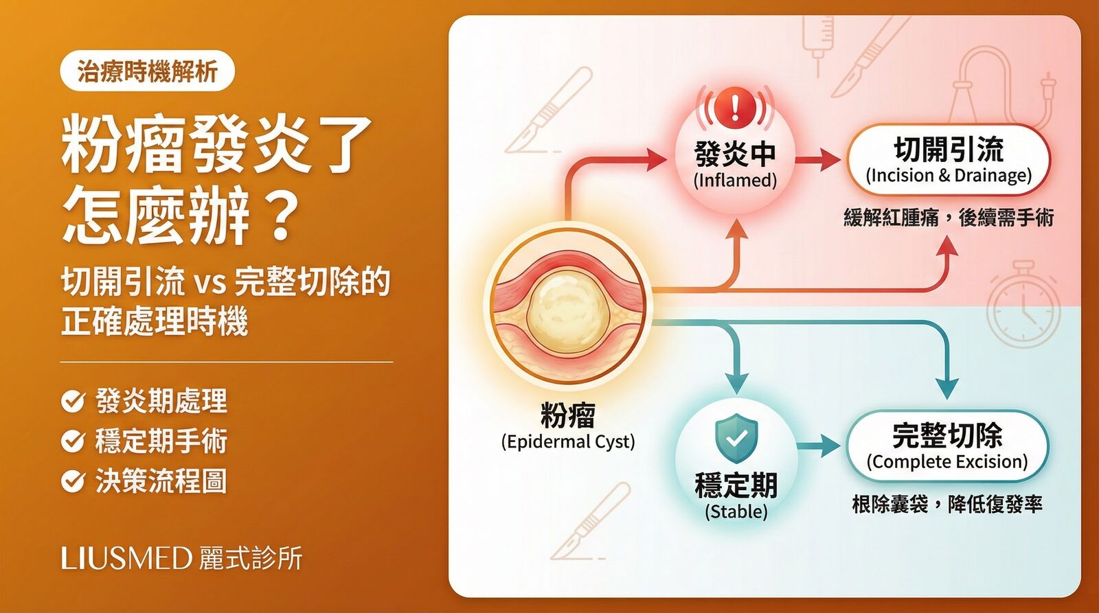 粉瘤發炎了怎麼辦？切開引流還是完整切除？醫師教你正確處理時機