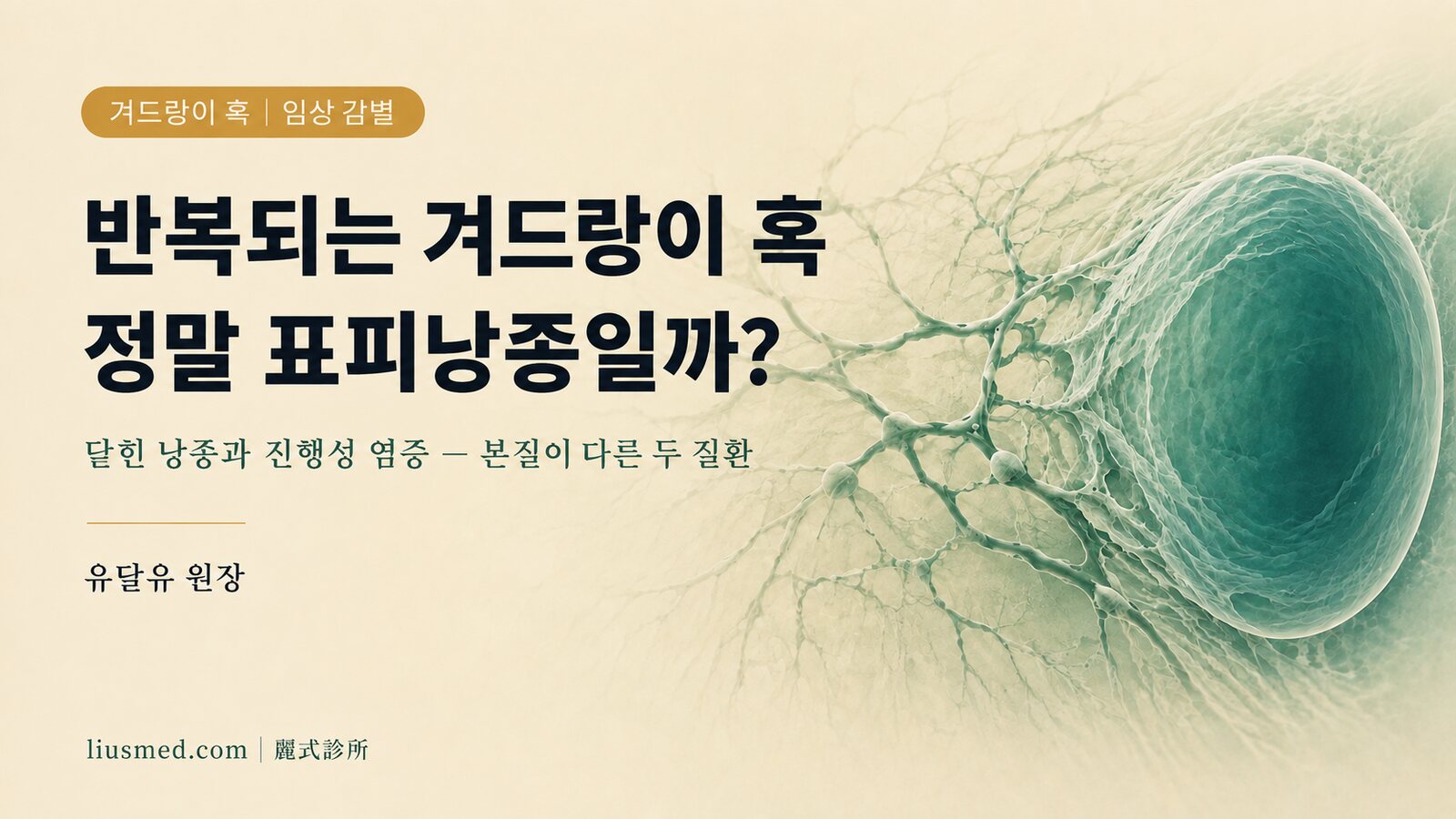 겨드랑이 혹, 표피낭종인가요 화농성한선염인가요? 임상 감별 안내