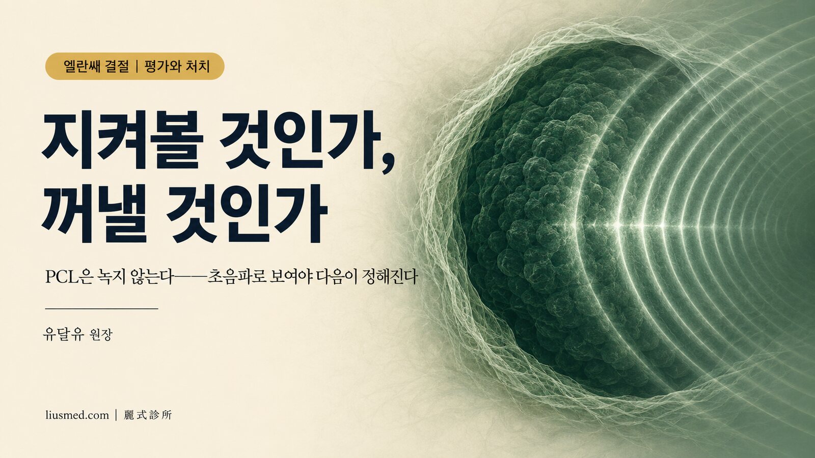 엘란쎄 결절, 어떻게 하나? 초음파로 확인한 뒤 경과관찰인지 제거인지 정합니다