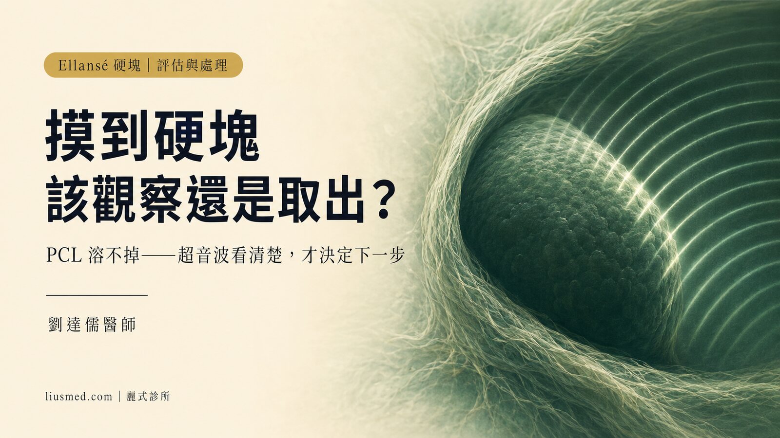 洢蓮絲硬塊怎麼處理？先看清楚是什麼，再決定觀察還是取出