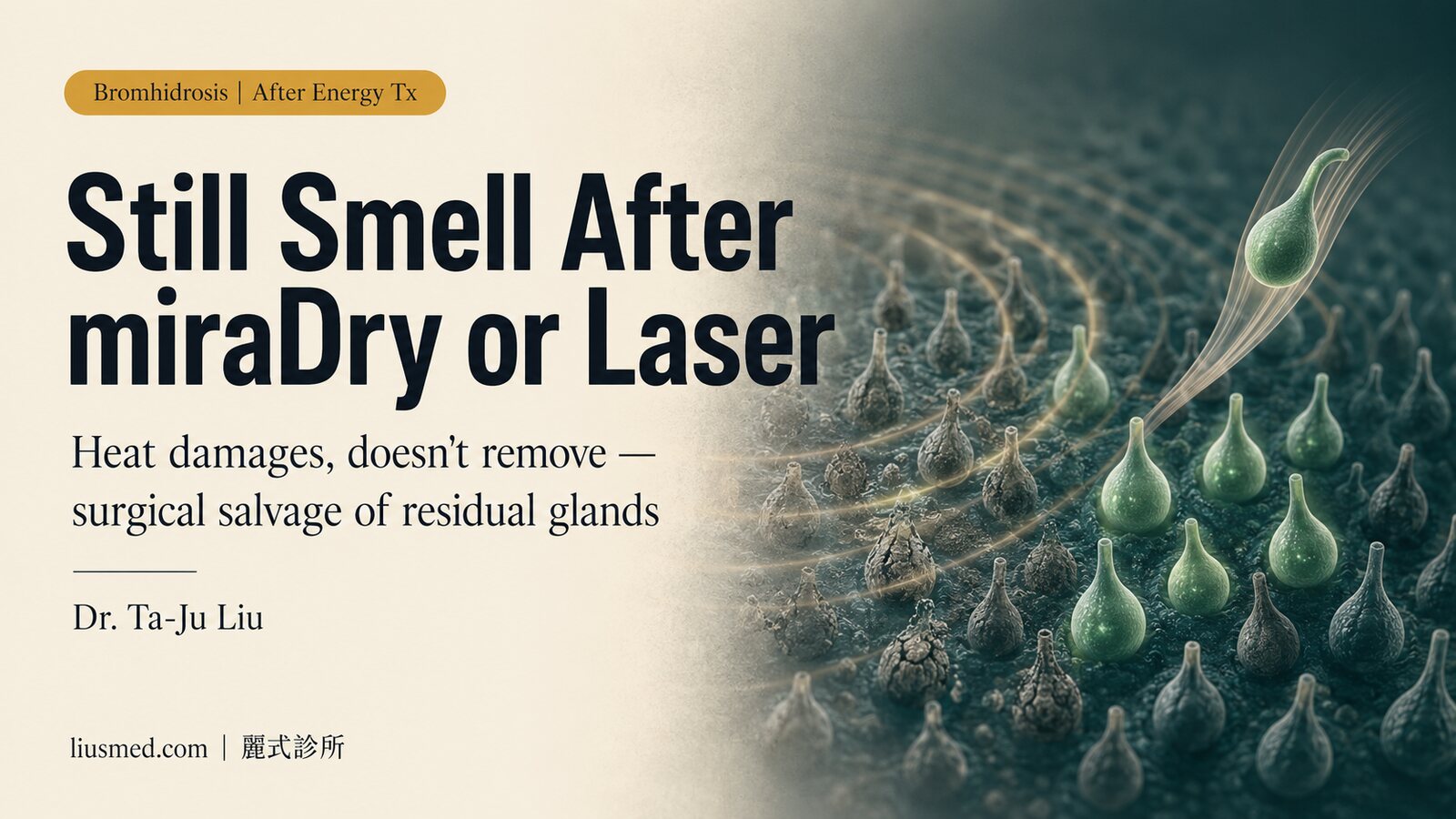 Still Smell After miraDry or Laser? The Salvage Clearing After Energy-Based Treatment