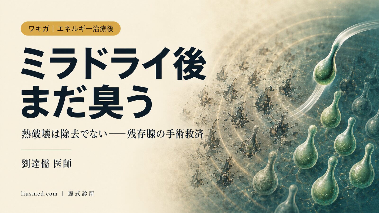 ミラドライやレーザーの後もまだ臭う？エネルギー治療後の救済的な除去