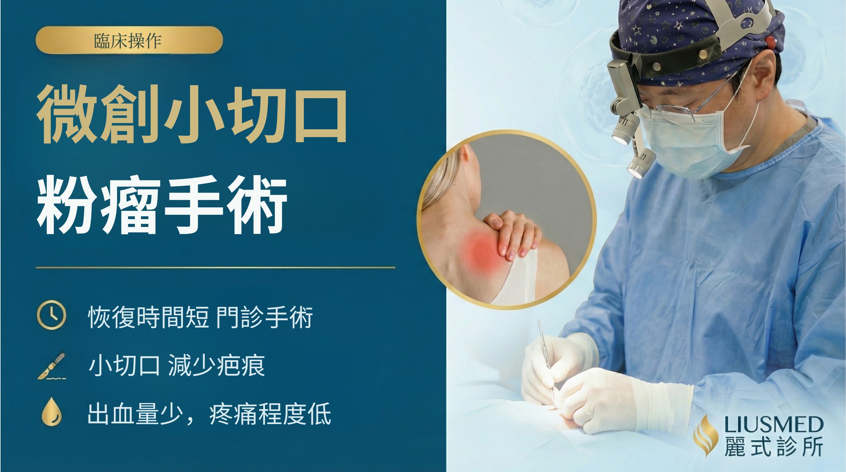 粉瘤完整指南：成因、症狀與微創手術治療