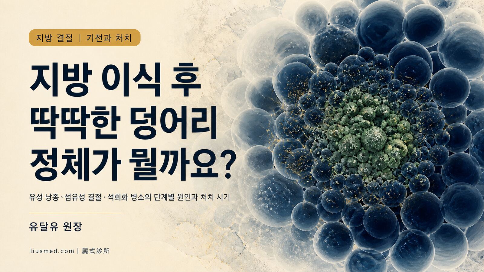 자가지방 이식 후 딱딱한 덩어리·석회화가 생겼다면? 지방 결절의 원인·예방·처치 시기