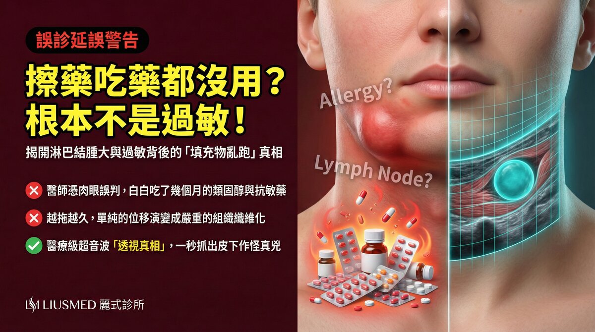 填充物併發症常見誤診:被當成過敏、淋巴結腫大的真實案例