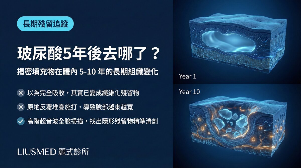 填充物在組織中5到10年會發生什麼變化?