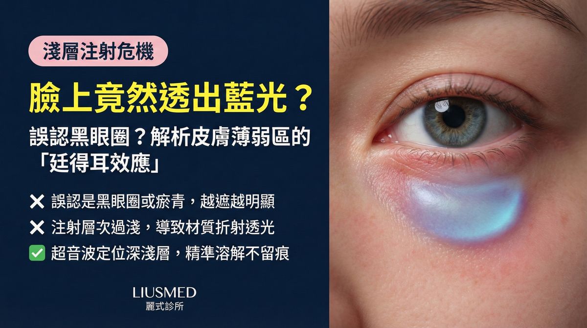 某些角度能透光看到填充物?皮膚薄區域的注射風險