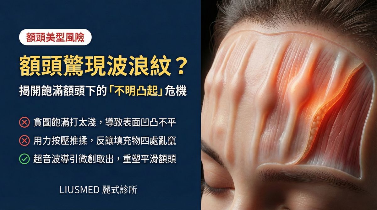 額頭打完填充物出現不明凸起或波浪紋路
