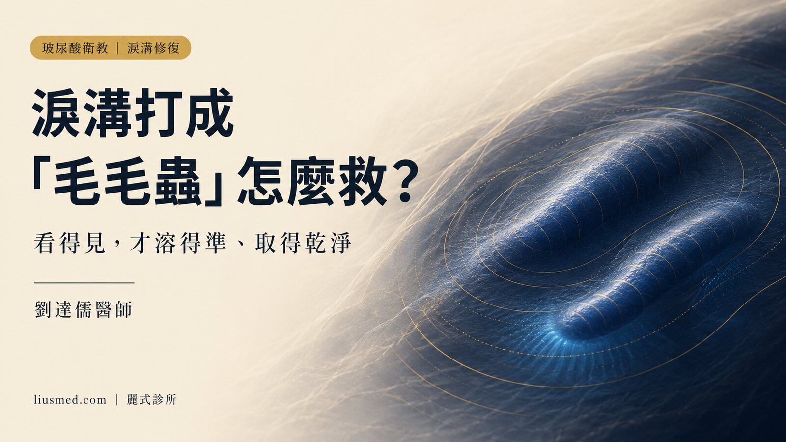 淚溝玻尿酸為什麼會變「毛毛蟲」?怎麼打不踩雷、變了又怎麼救