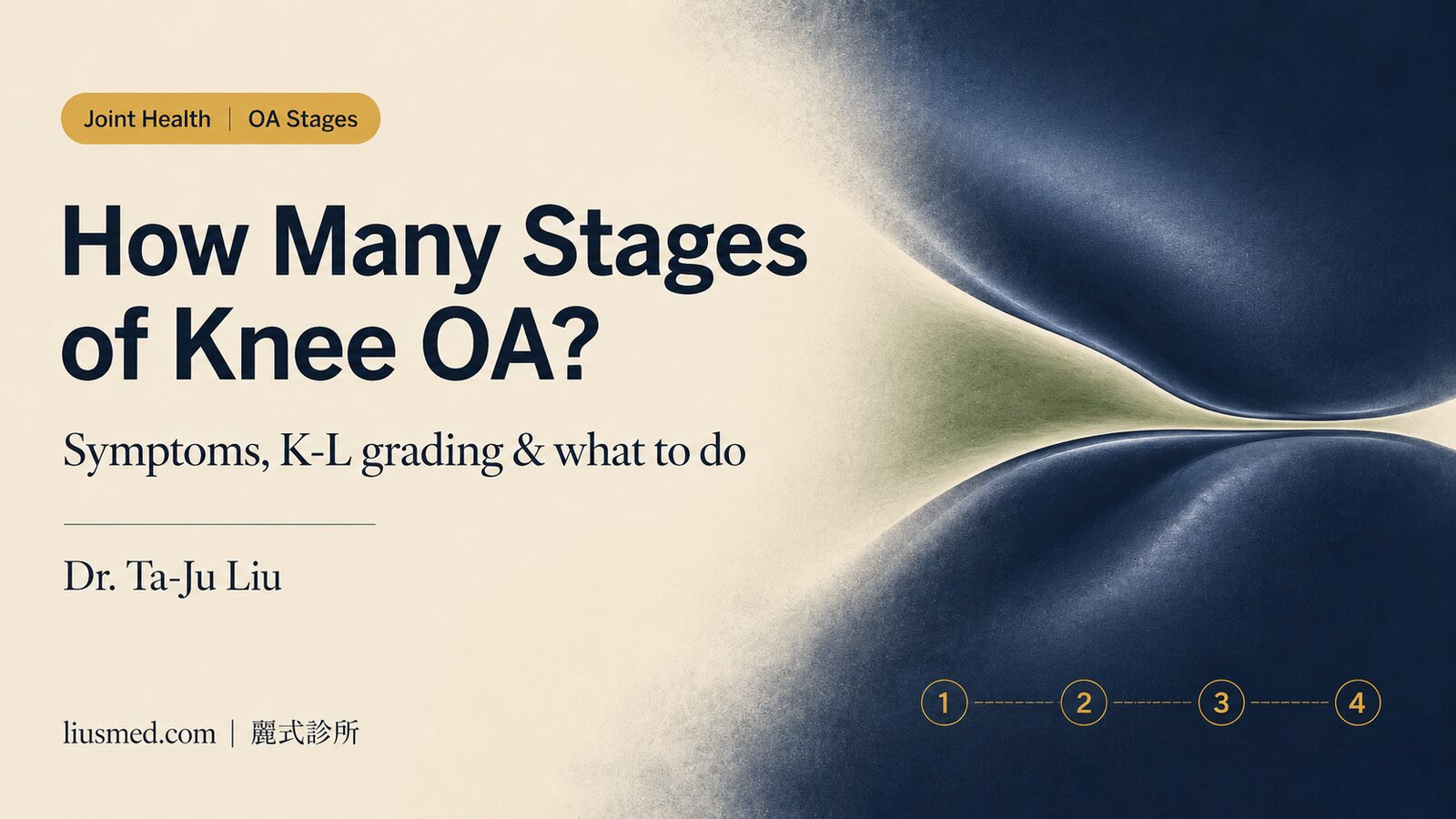 How Many Stages Does Knee Osteoarthritis Have? Symptoms, K-L Grading, and What to Do at Each Stage