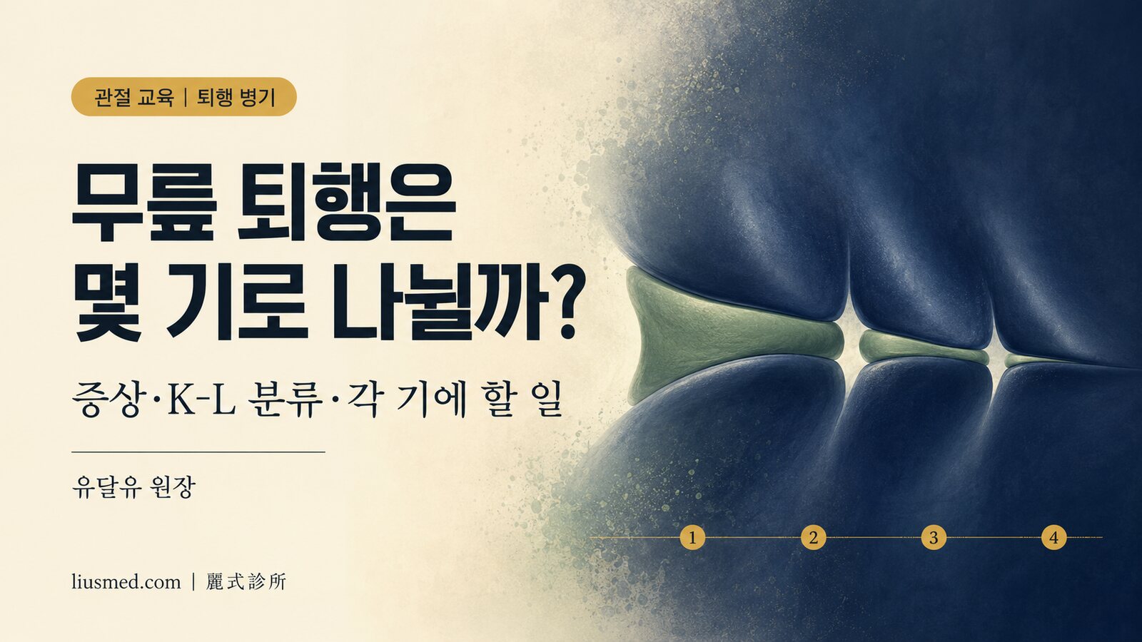 무릎 퇴행은 몇 기로 나뉠까? 퇴행성 관절염의 증상·K-L 분류·각 기에 할 일