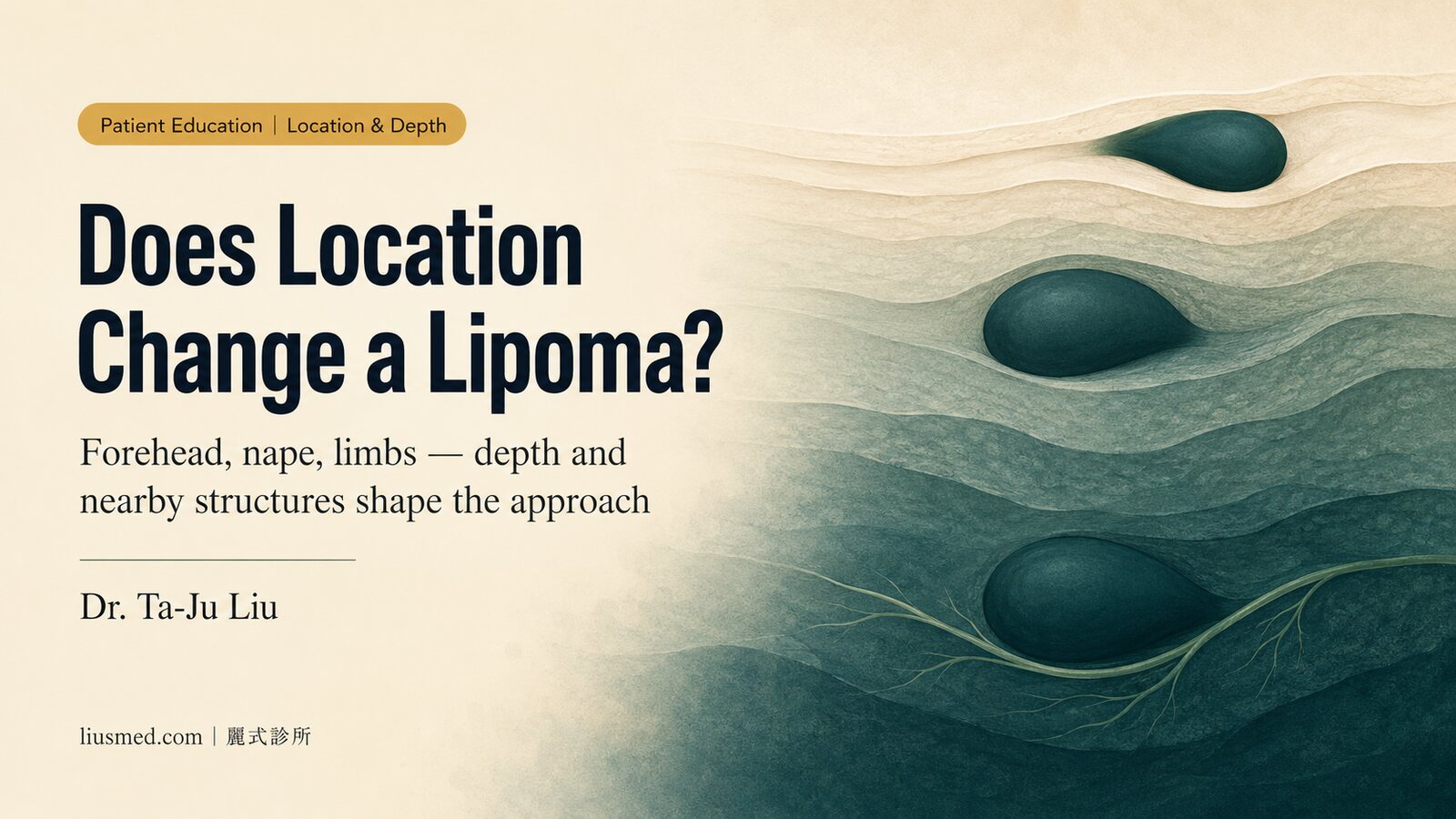Does It Matter Where a Lipoma Grows? Forehead, Nape, Back, Shoulder, and Limbs — Depth and Treatment Considerations