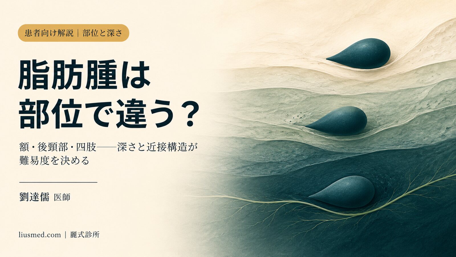 脂肪腫はできる部位で違う?額・後頸部・背中・肩・四肢の深さと治療上の考慮点