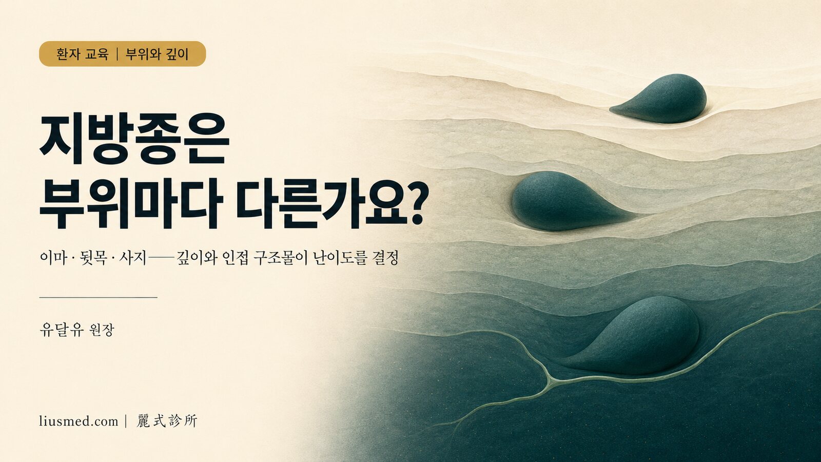지방종은 생긴 부위에 따라 다른가요? 이마·뒷목·등·어깨·사지의 깊이와 치료 고려사항