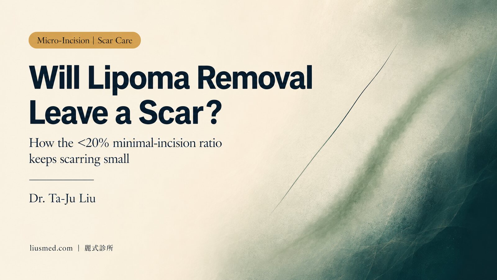 Will Lipoma Removal Leave a Noticeable Scar? The <20% Micro-Incision Approach and Post-Op Scar Care Guide