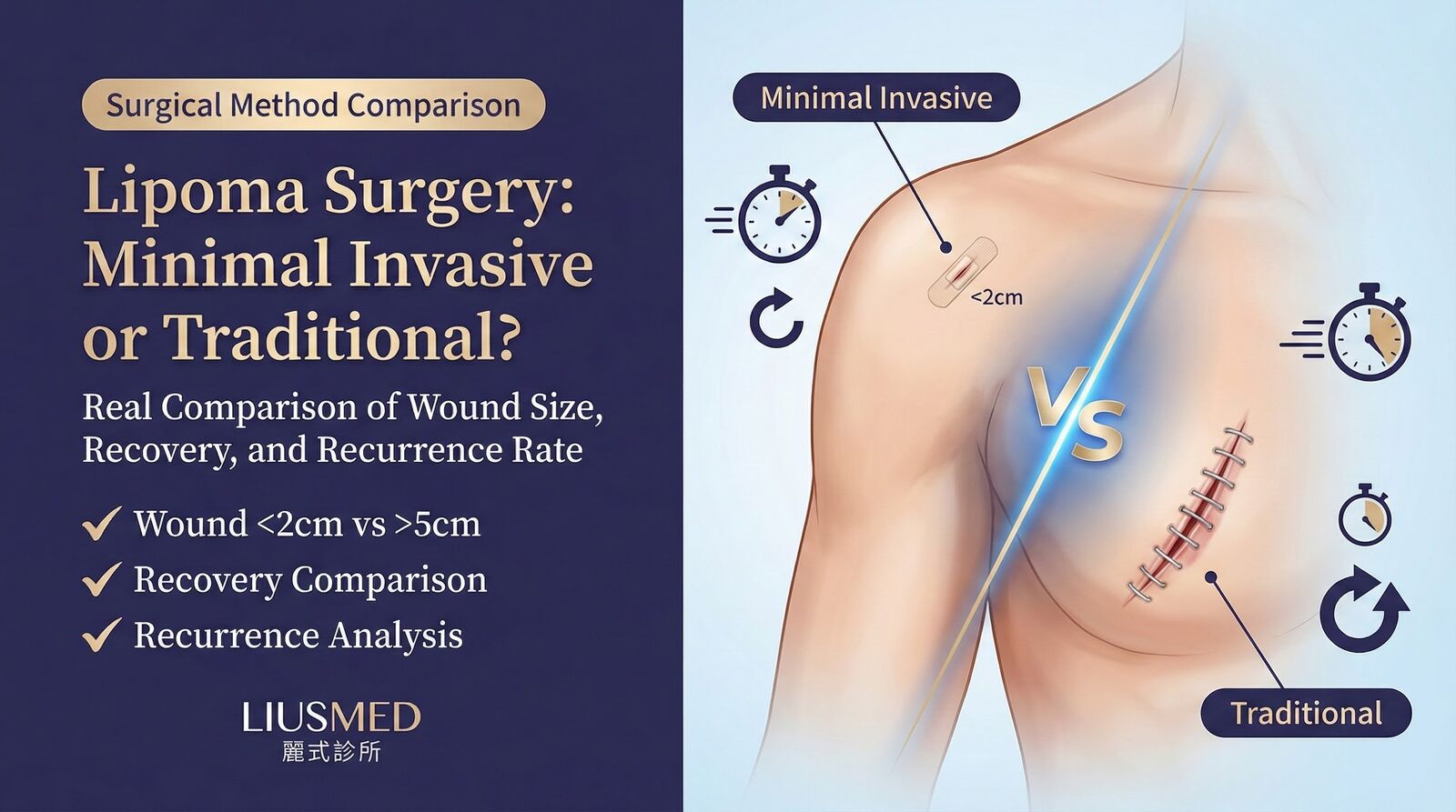 Lipoma Surgery: Minimal Incision vs Traditional - Comparing Wound Size, Recovery & Recurrence
