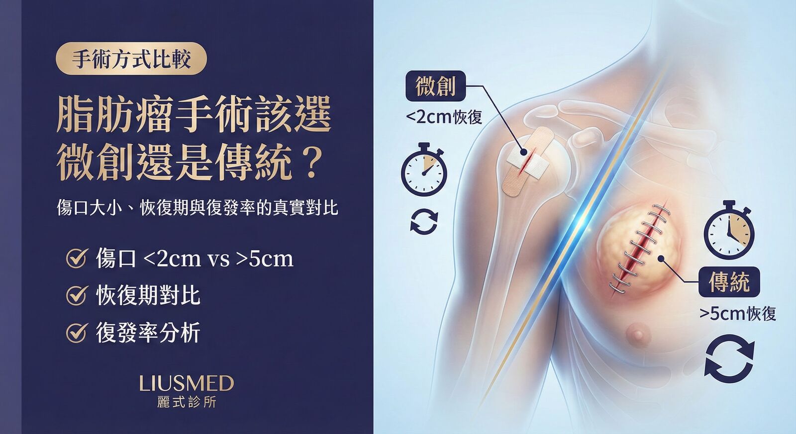 脂肪瘤手術該選微創還是傳統？傷口大小、恢復期與復發率的真實對比