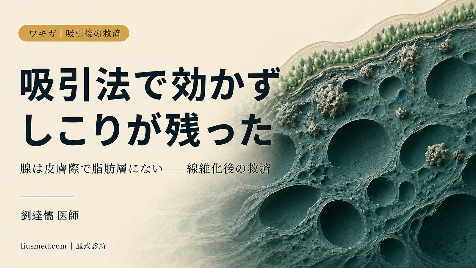 吸引法でワキガを治したのに臭いが改善せず、しこりが残った?吸引後に線維化したワキの救済手術