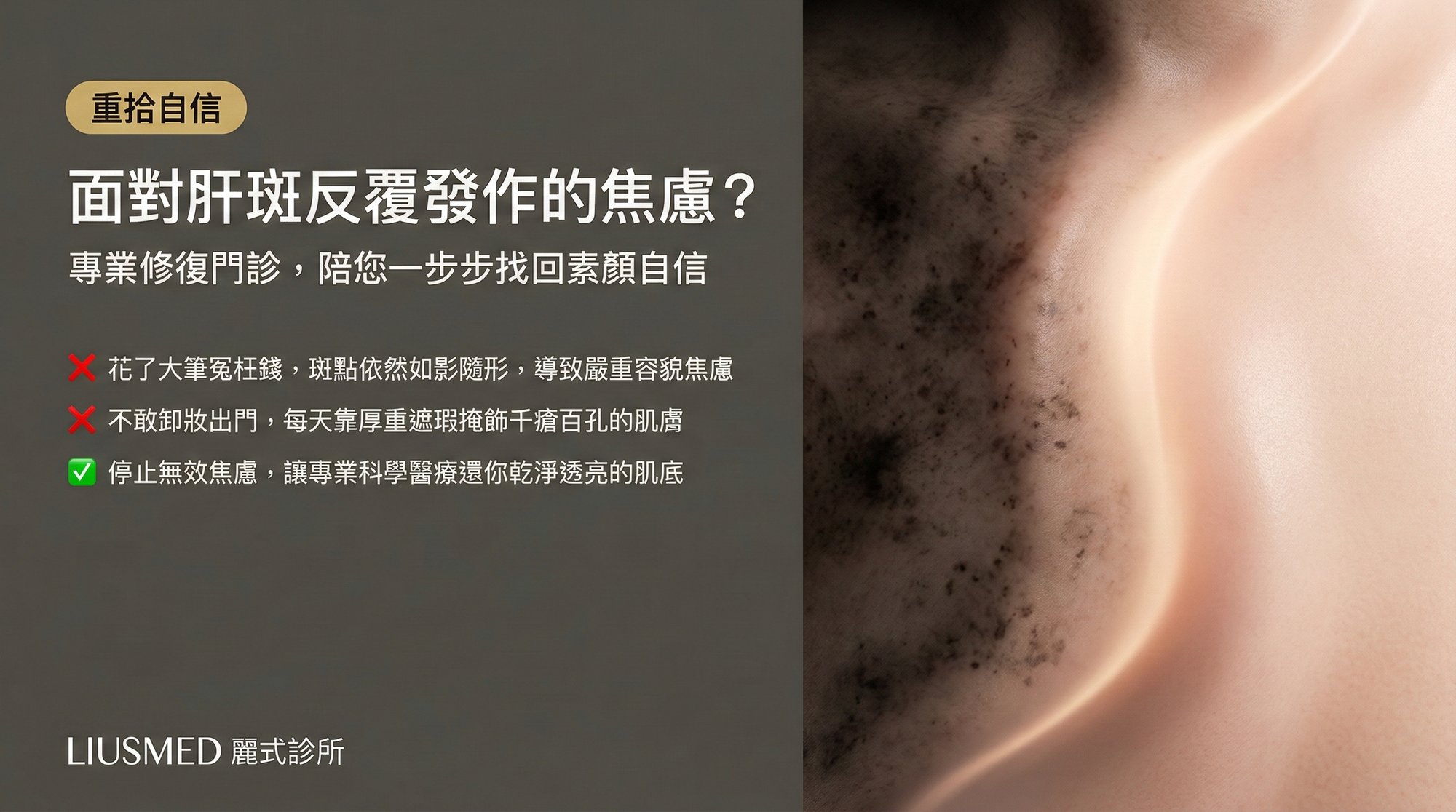 面對肝斑反覆發作的焦慮,專業修復門診如何幫你找回素顏自信?