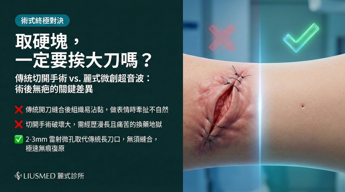 微創超音波取出 vs 傳統開刀切除:術後結果全面比較