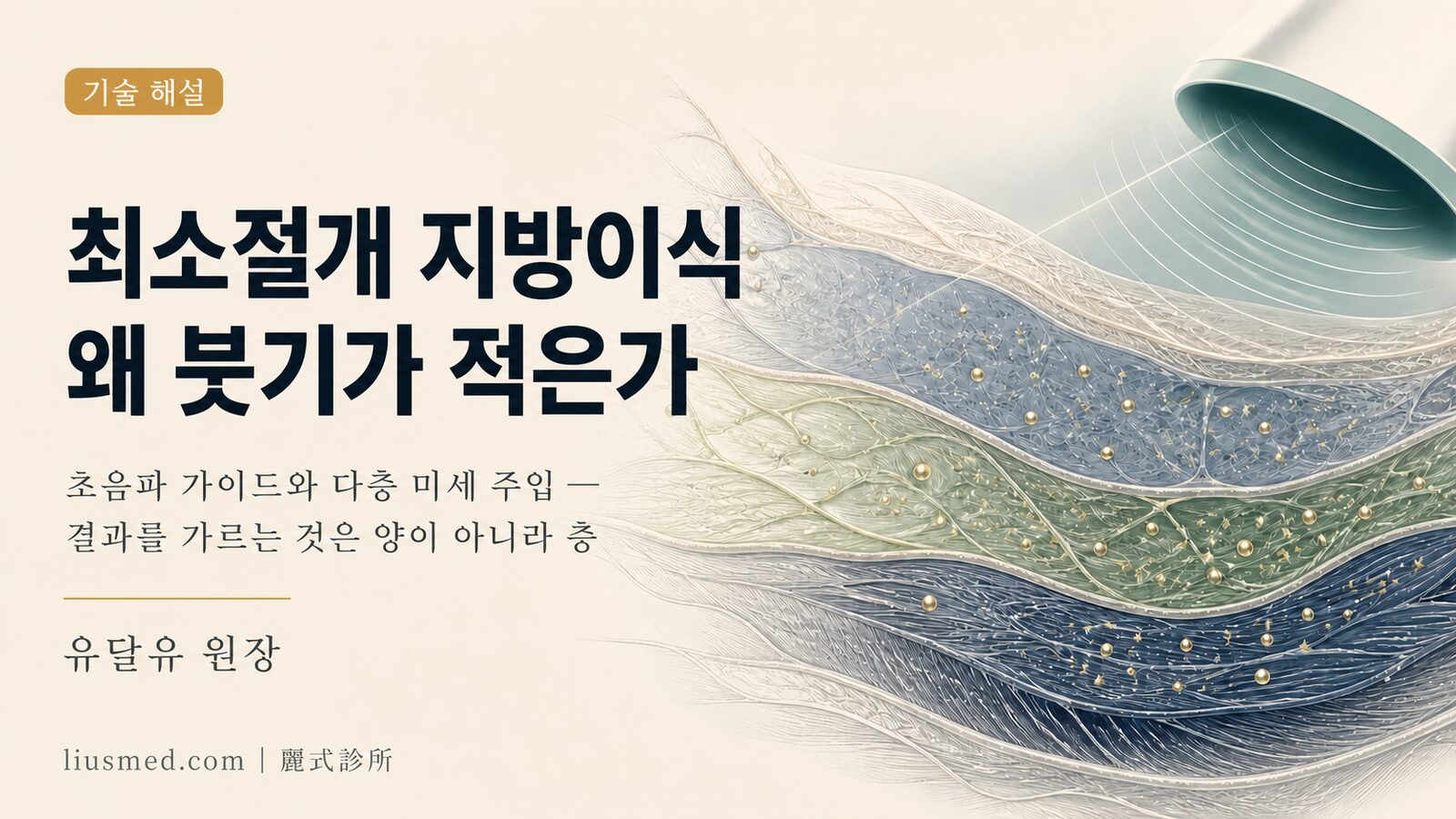 최소절개 지방이식은 왜 붓기가 적고 자연스러운 결과를 만드는가? 초음파 가이드 채취와 다층 주입 기술 해설