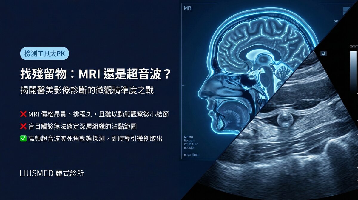 檢查臉部殘留物,MRI核磁共振與高解析度超音波哪一種更精準?