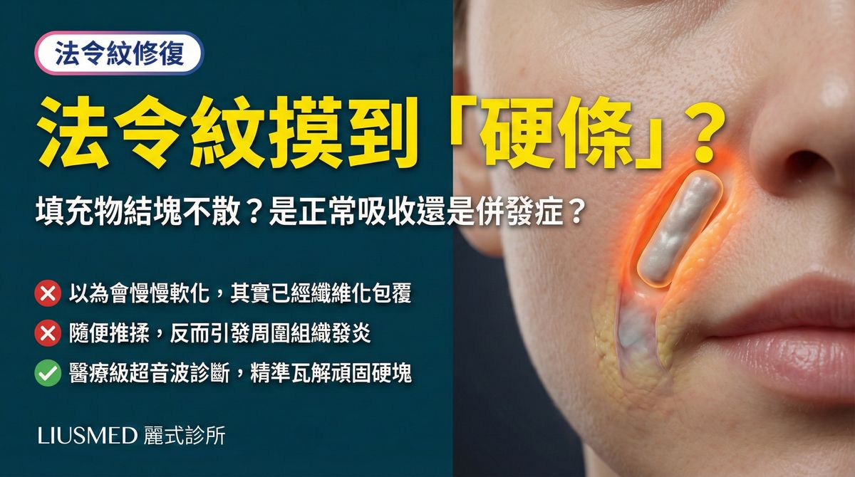 法令紋打完填充物摸到硬條狀物,是正常還是併發症?