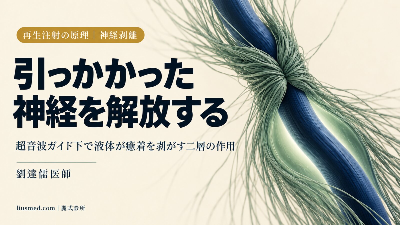 神経ハイドロダイセクションの原理:超音波ガイド下で、液体はどのように神経を解放するのか