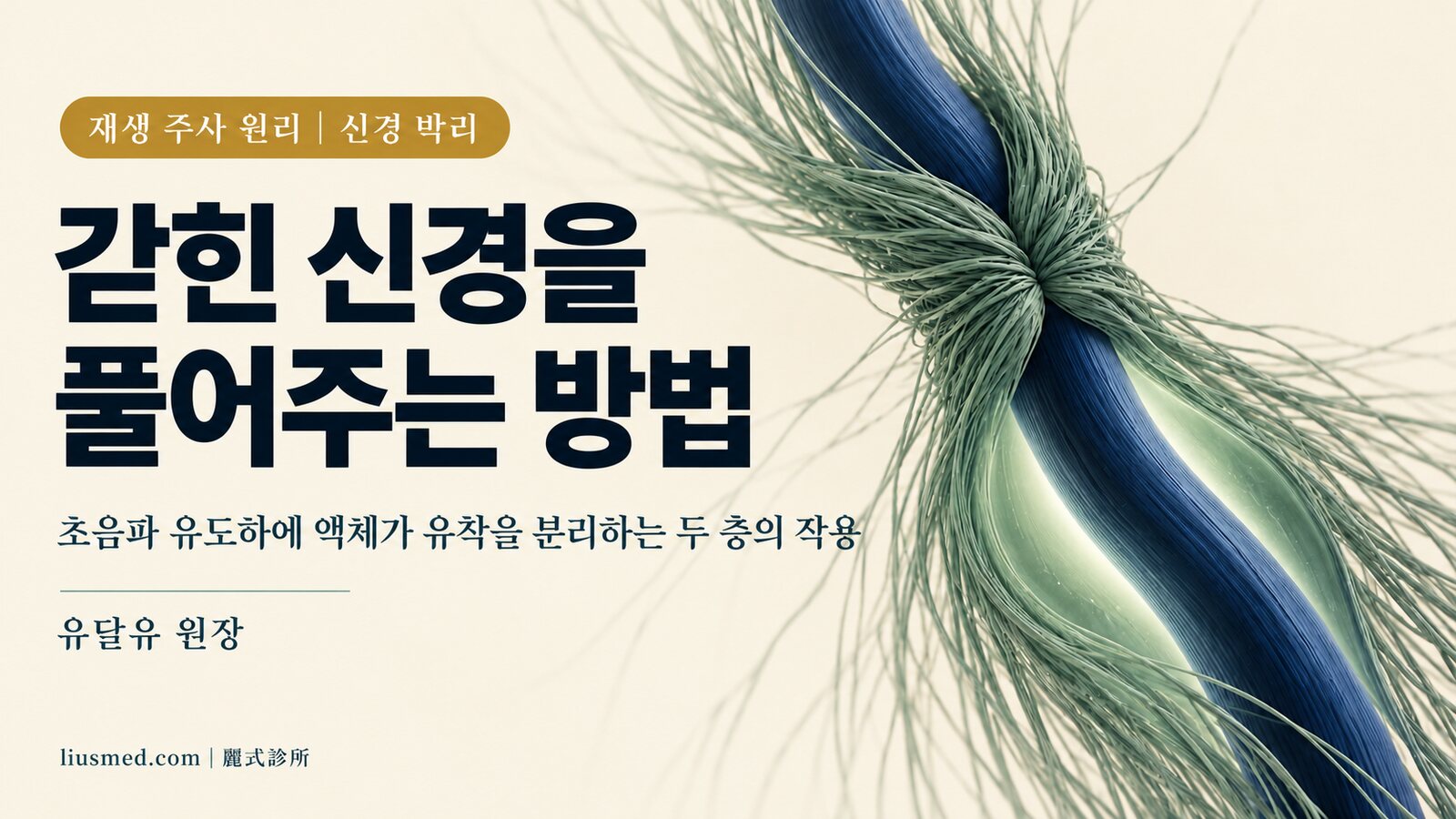 신경 박리 주사의 원리: 초음파 유도하에서 액체는 어떻게 갇힌 신경을 풀어주는가