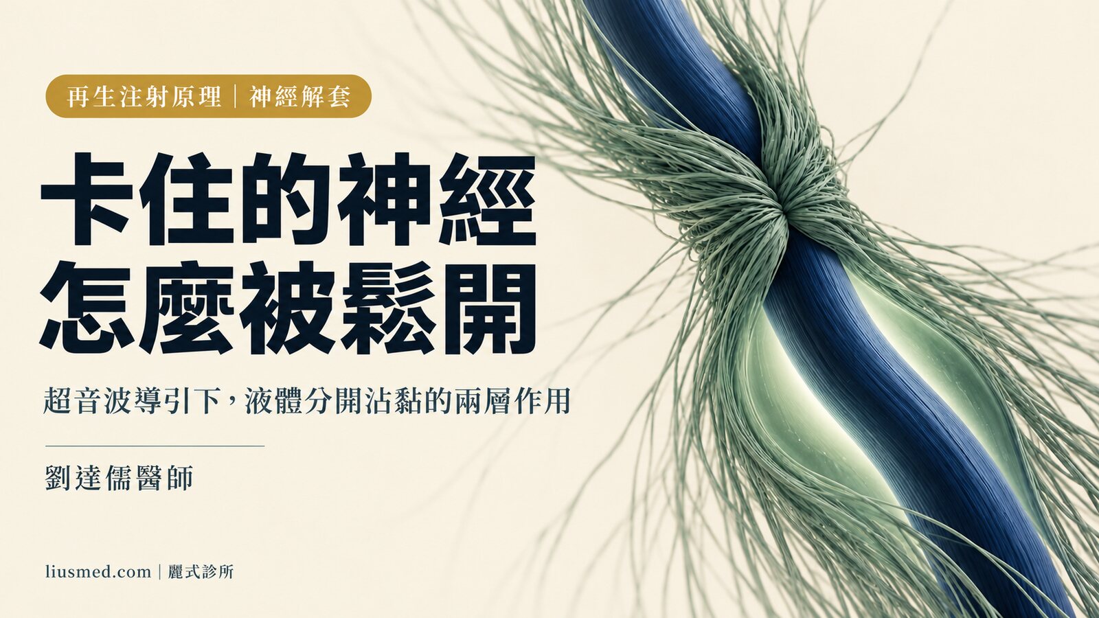 神經解套注射原理：超音波導引下，液體怎麼把卡住的神經鬆開