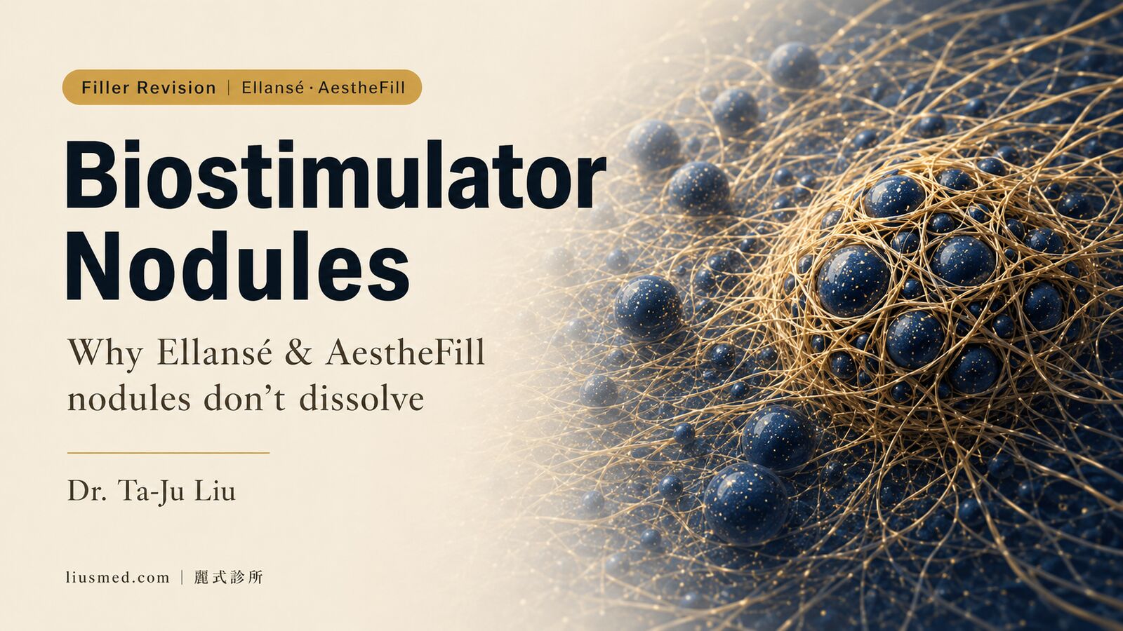 Ellansé & AestheFill Nose Nodules: Why They Don’t Dissolve, and How to Remove Them