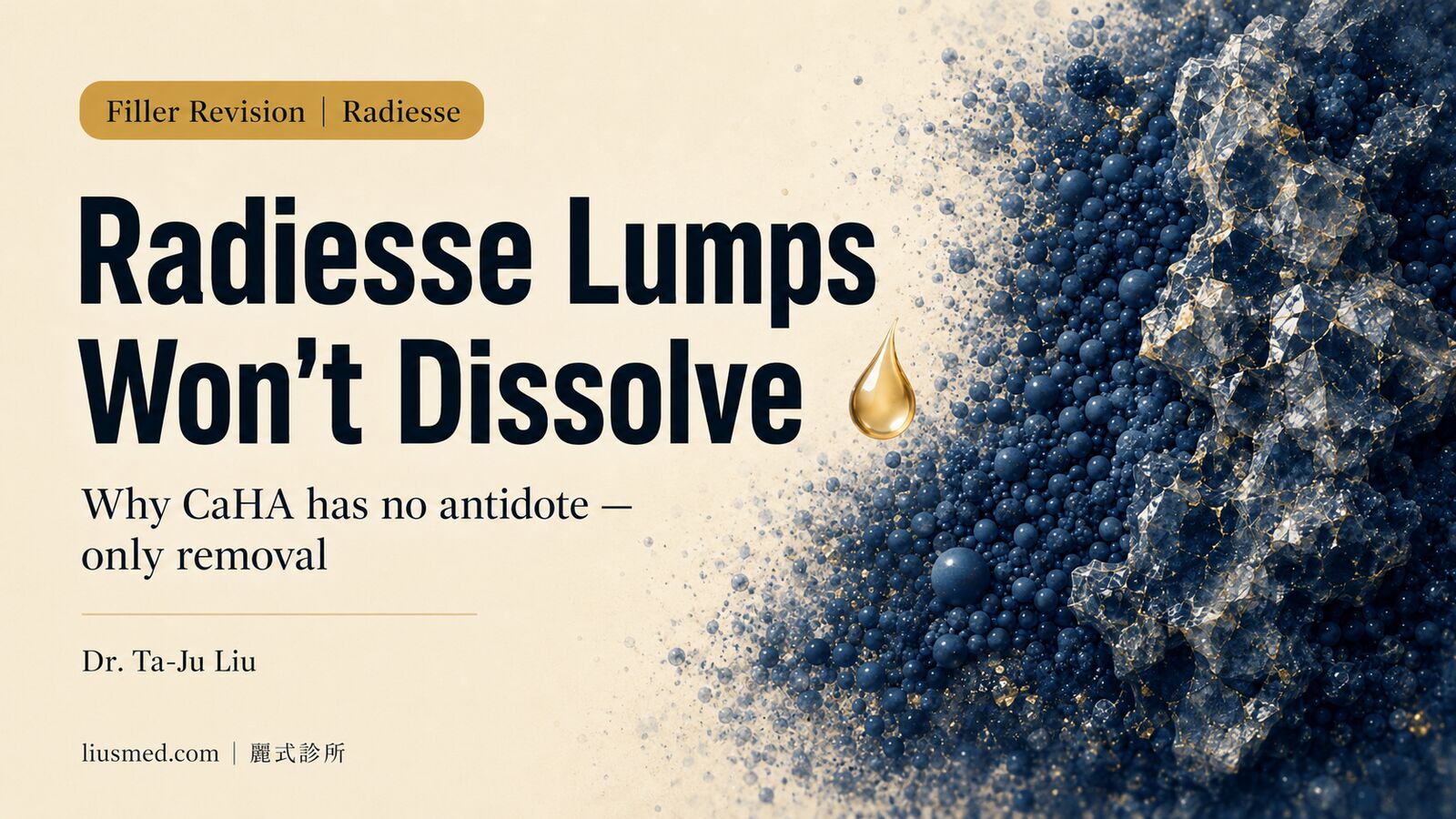 Radiesse Nose Lump? It Can’t Be Dissolved — Only Removed