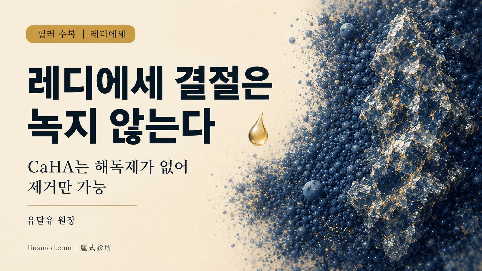 레디에세 코 결절? 녹지 않습니다 — 제거만 가능