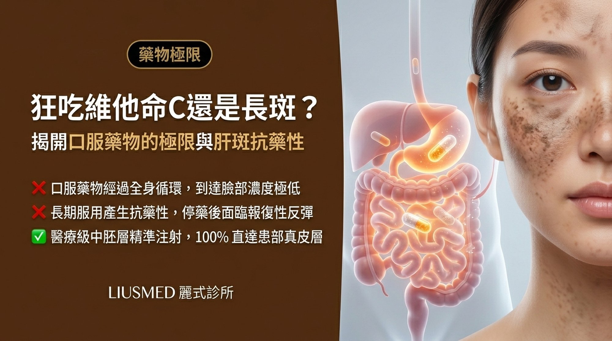 狂吃維他命 C 跟傳明酸還是長斑?口服藥物的極限與肝斑抗藥性