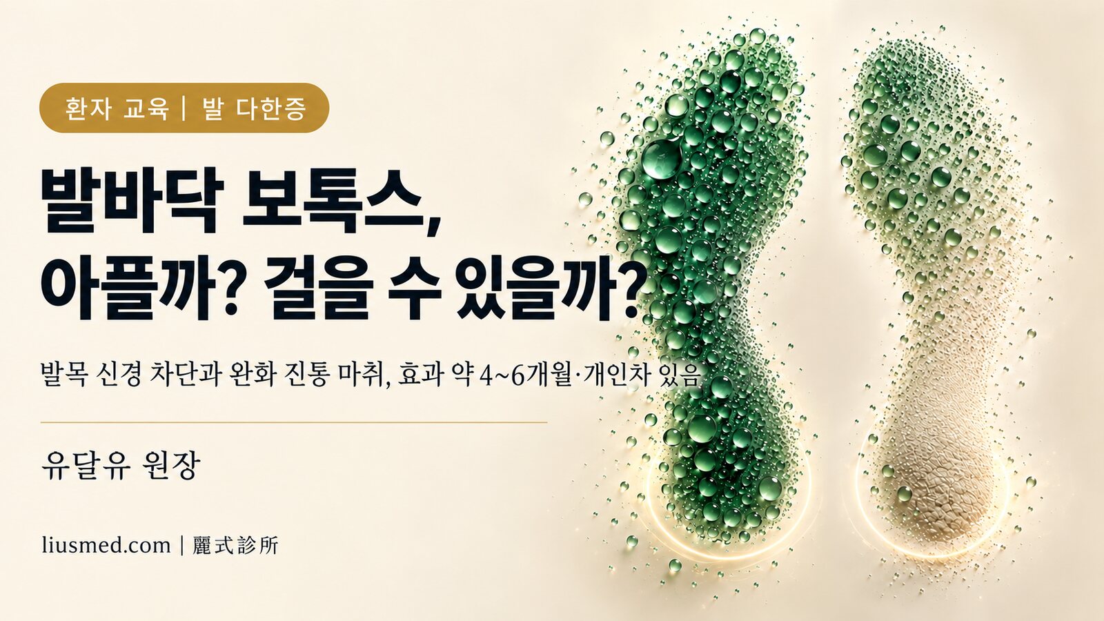발바닥 보톡스로 발 다한증 치료: 아픈가요, 당일 걸을 수 있나요, 얼마나 가나요