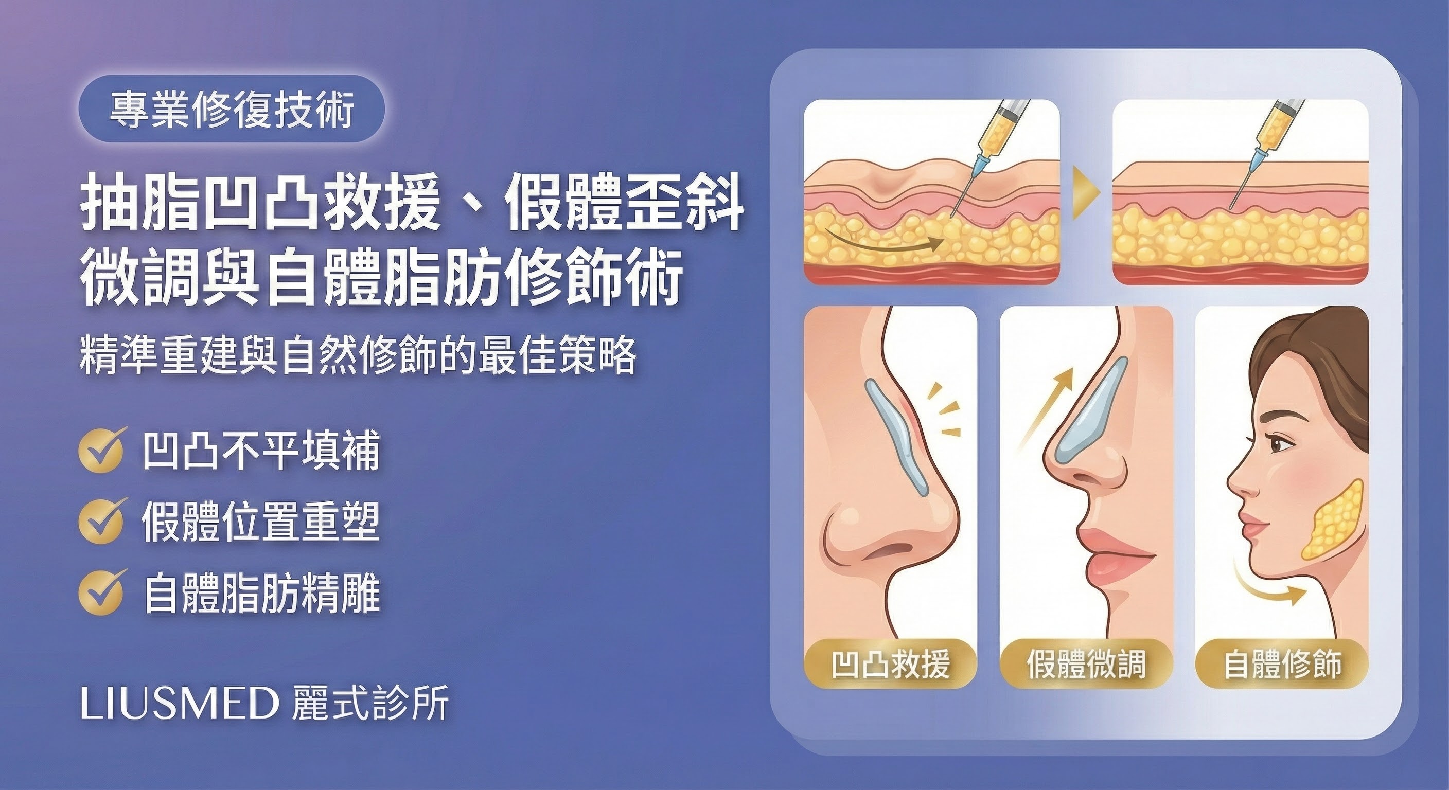 整形修復專家:抽脂凹凸救援、假體歪斜微調與自體脂肪修飾術