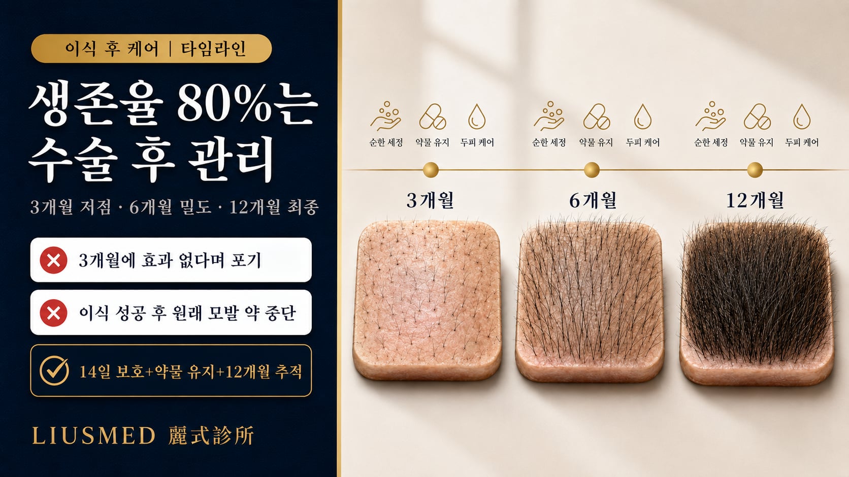 모발 이식 후 3/6/12개월 유지 관리 완벽 체크리스트: 각 단계에 해야 할 일과 피해야 할 일(2026 근거 기반)