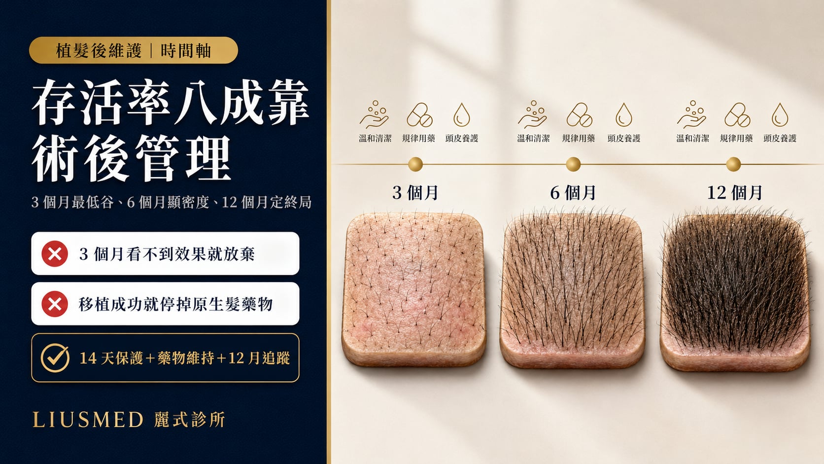 植髮後 3／6／12 個月維護完整清單：每個階段該做什麼、不該做什麼（2026 實證版）