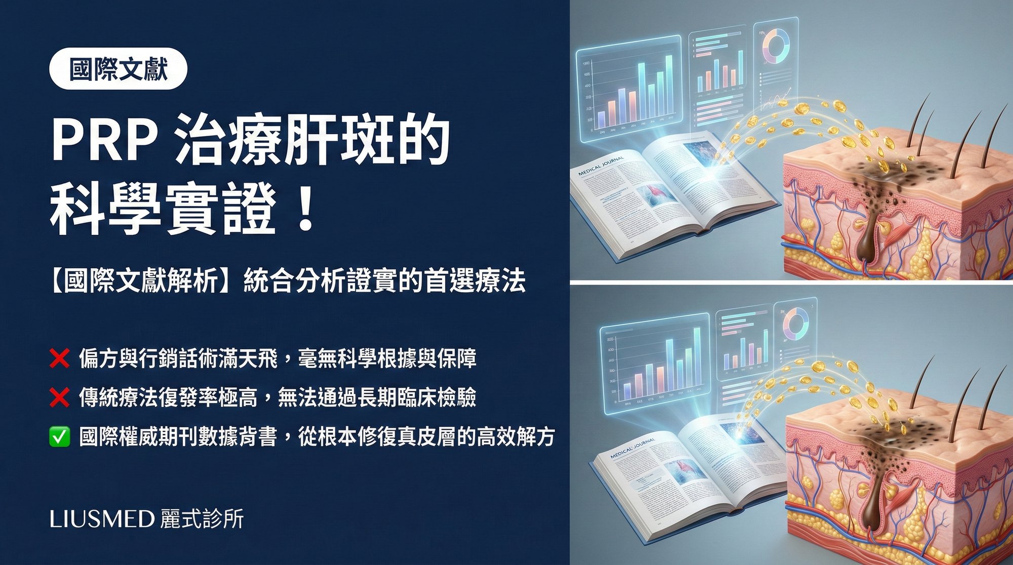 【國際文獻解析】統合分析證實:PRP 注射為何成為治療肝斑的首選?