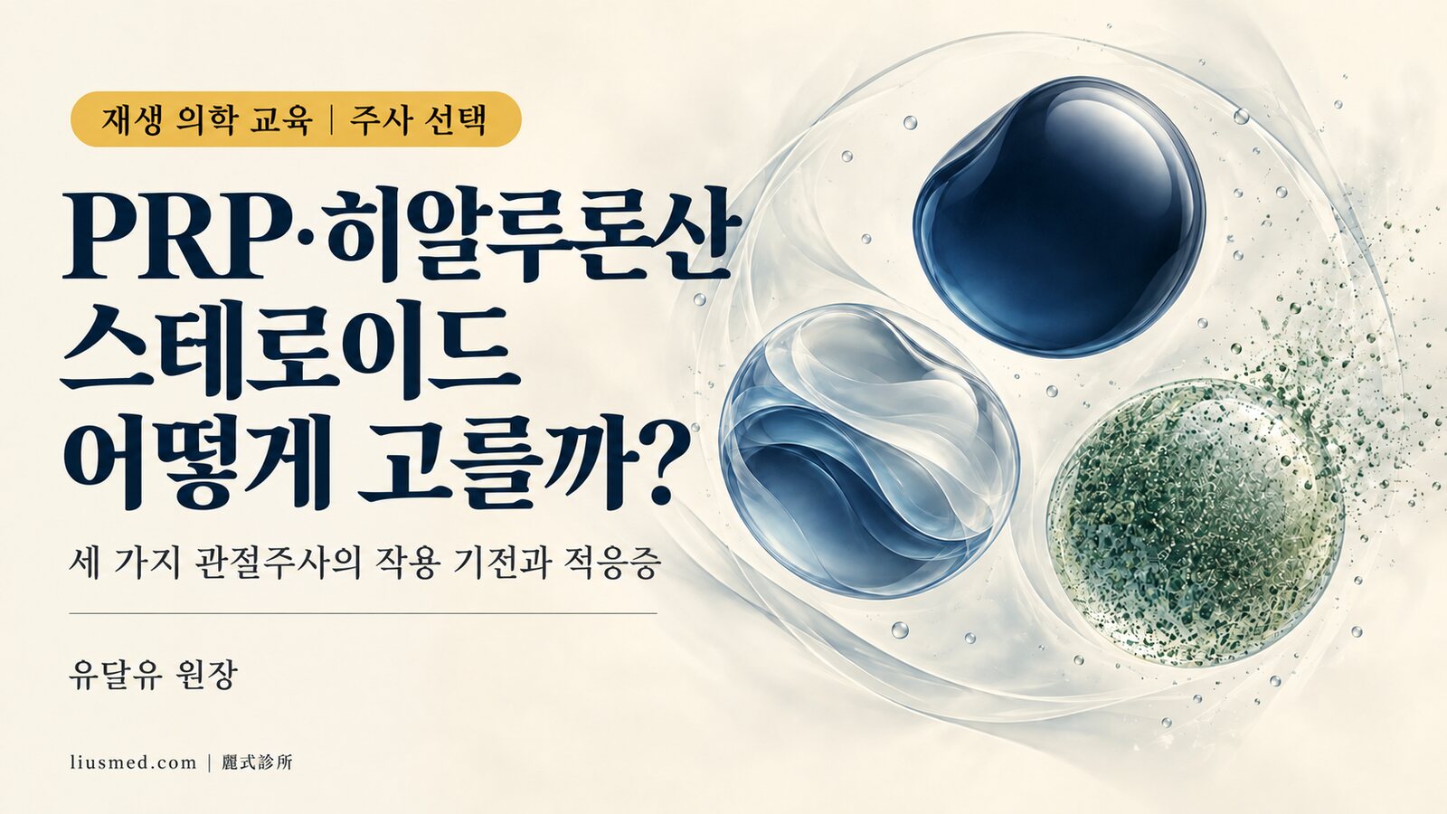 PRP·히알루론산·스테로이드 관절주사, 어떻게 고를까? 세 가지 작용 기전과 적응증