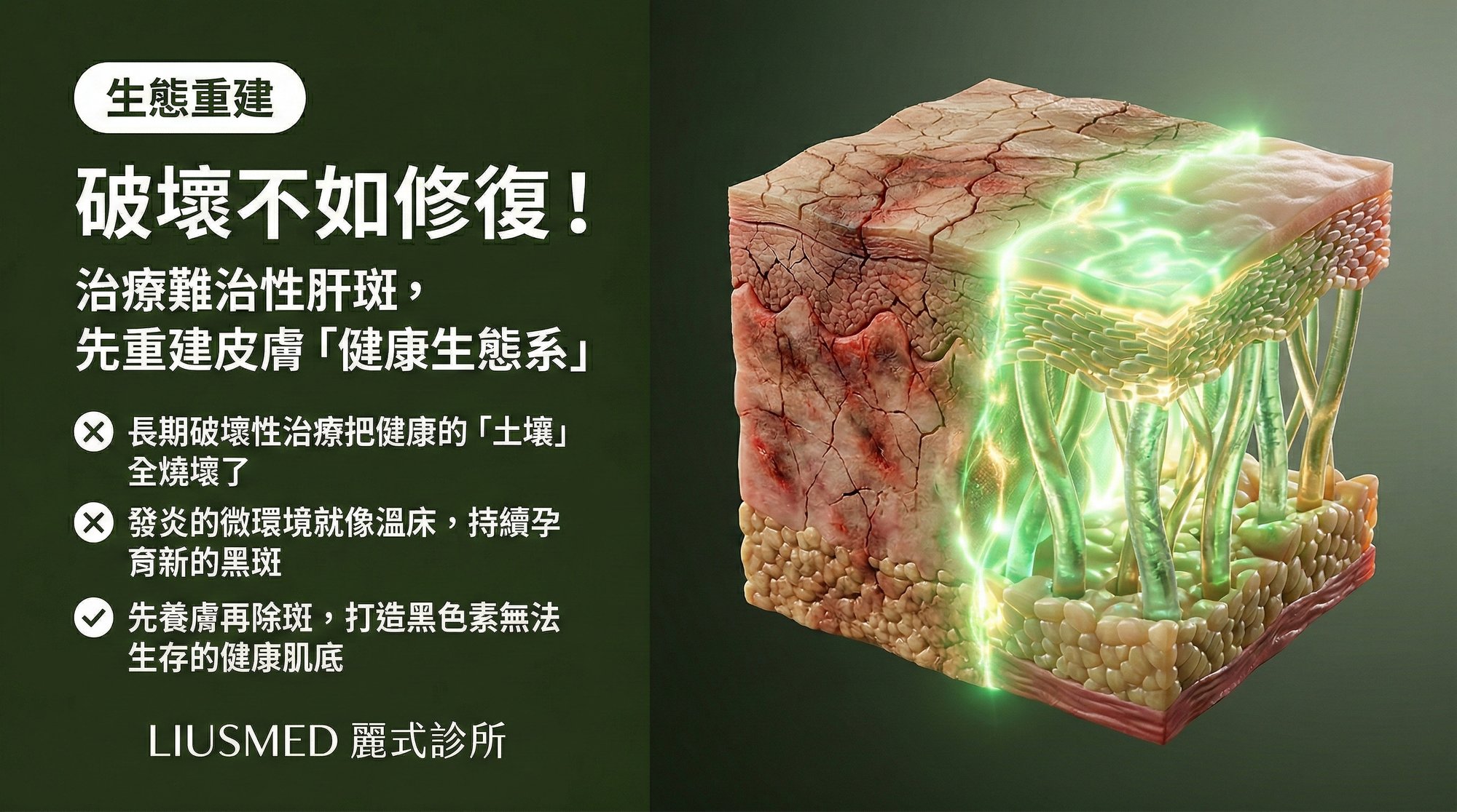 破壞不如修復!為什麼治療難治性肝斑必須先重建皮膚的「健康生態系」?