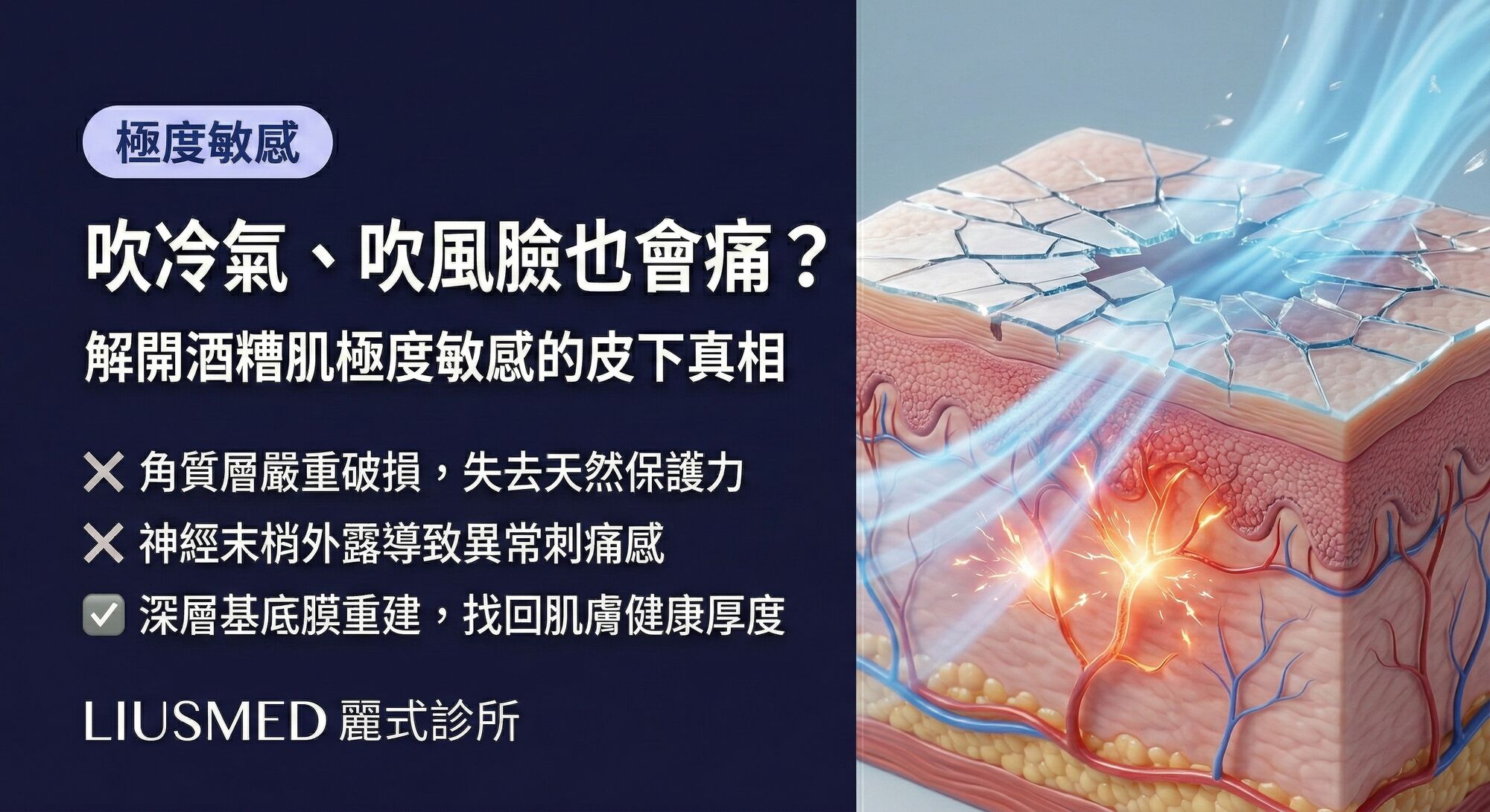 吹冷氣臉也會痛?解開酒糟肌「極度敏感、吹風就刺痛」的皮下真相